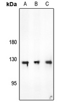 Focal Adhesion Kinase Rabbit Polyclonal Antibody