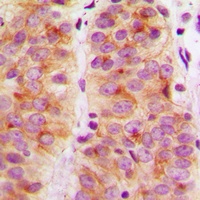 Anti-Focal Adhesion Kinase Antibody