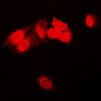 Anti-Focal Adhesion Kinase Antibody