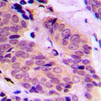 Anti-ABCD4 Antibody