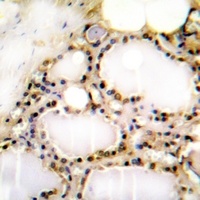 Anti-RAD52 (Phospho-Y104) Antibody