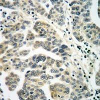 Anti-RALB Antibody