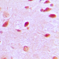 Anti-RAP1GAP Antibody