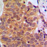 Anti-RAR beta Antibody
