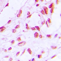 Anti-RB1 (Phospho-S780) Antibody