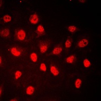 Anti-RB1 (Phospho-S780) Antibody
