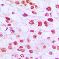 Anti-RB1 Antibody