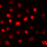 Anti-RB1 Antibody