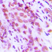Anti-NF-kappaB p65 (Phospho-S276) Antibody