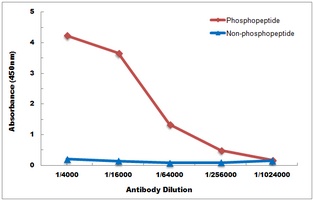 Anti-NF-kappaB p65 (Phospho-S276) Antibody