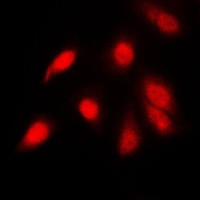 Anti-NF-kappaB p65 (Phospho-S311) Antibody