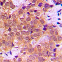 NF-kappaB p65 (Phospho-S468) Antibody