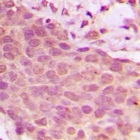 Anti-NF-kappaB p65 (Phospho-S536) Antibody