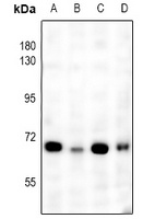 NF-kappaB p65 Antibody