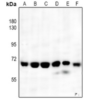NF-kappaB p65 Antibody