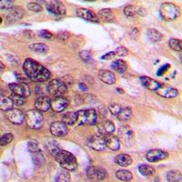 NF-kappaB p65 Antibody