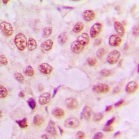 NF-kappaB p65 Antibody