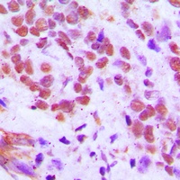 Anti-RFX3 Antibody