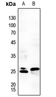 RGS1 Rabbit Polyclonal Antibody
