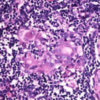 RGS1 Rabbit Polyclonal Antibody