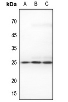 RIT1 Rabbit Polyclonal Antibody