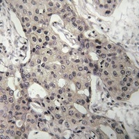 Anti-RPL3 Antibody