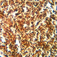 Anti-RPL11 Antibody