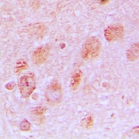 Anti-RPL17 Antibody