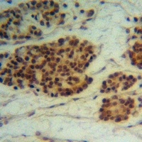 Anti-MRPL12 Antibody