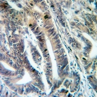 Anti-MRPS12 Antibody