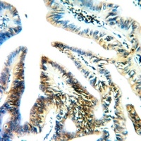 Anti-RPS4X Antibody