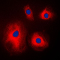 Anti-RPS4X Antibody