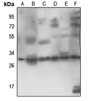 RPS4Y1 Antibody