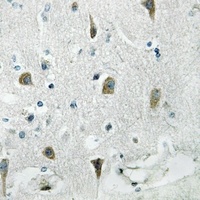 Anti-RPS4Y1 Antibody