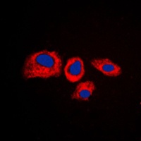 RPS4Y1 antibody