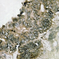 RSK1 (Phospho-S380) Antibody