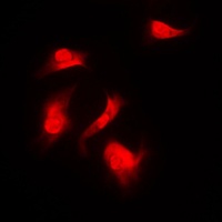 RPS6KB1 (phospho-S418) antibody