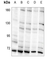 S6K1 (Phospho-T421) Antibody