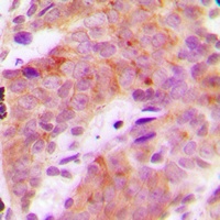 S6K1 (Phospho-T421) Antibody
