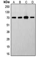 S6K1 Rabbit Polyclonal Antibody