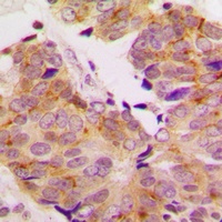 S6K1 Rabbit Polyclonal Antibody