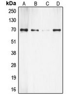 S6K1 Rabbit Polyclonal Antibody