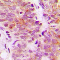 S6K1 Rabbit Polyclonal Antibody