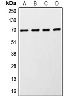 S6K1 Rabbit Polyclonal Antibody
