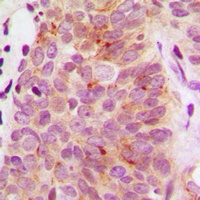 S6K1 Rabbit Polyclonal Antibody