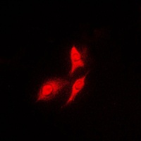 S6K1 Rabbit Polyclonal Antibody