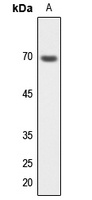 S6K1 Rabbit Polyclonal Antibody