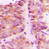 S6K1 Rabbit Polyclonal Antibody