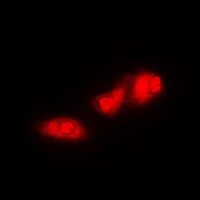 S6K1 Rabbit Polyclonal Antibody