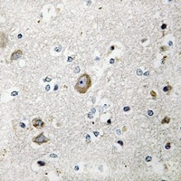Anti-RPS9 Antibody